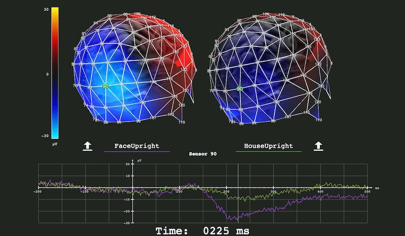 Colorful brains show the wonder of EEG Colorful brains show the wonder of EEG